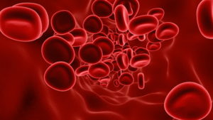 Cara mengatasi anemia defisiensi besi